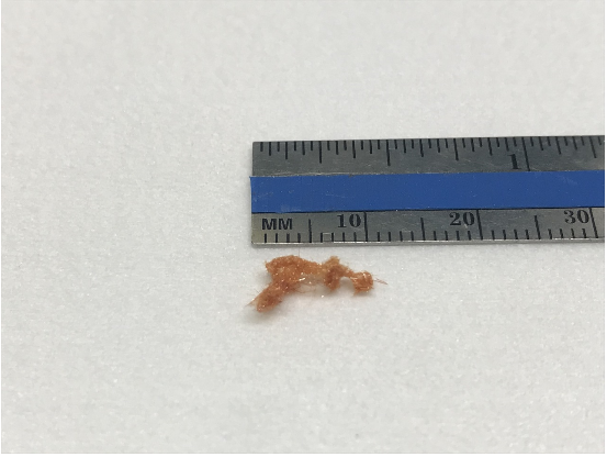 ZrS3 三硫化鋯晶體